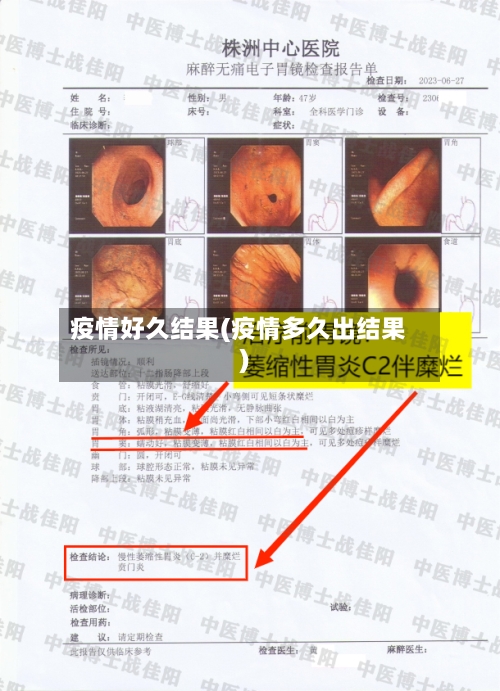 疫情好久结果(疫情多久出结果)-第1张图片