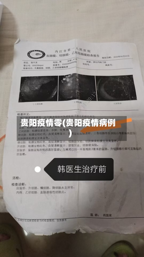 贵阳疫情零(贵阳疫情病例)-第3张图片